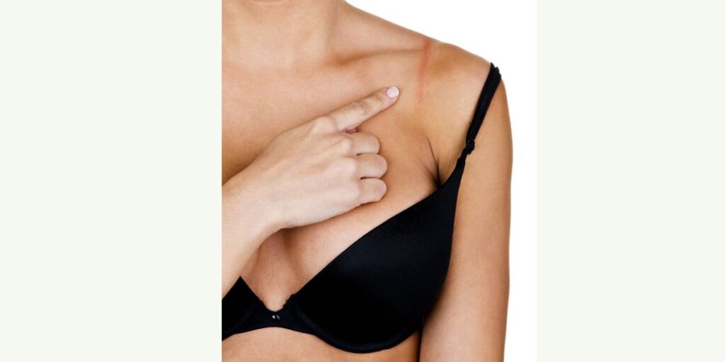 Bra Straps Digging into Shoulders